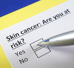 האם אתה נמצא בסיכון ללקות בסרטן העור?-תמונה